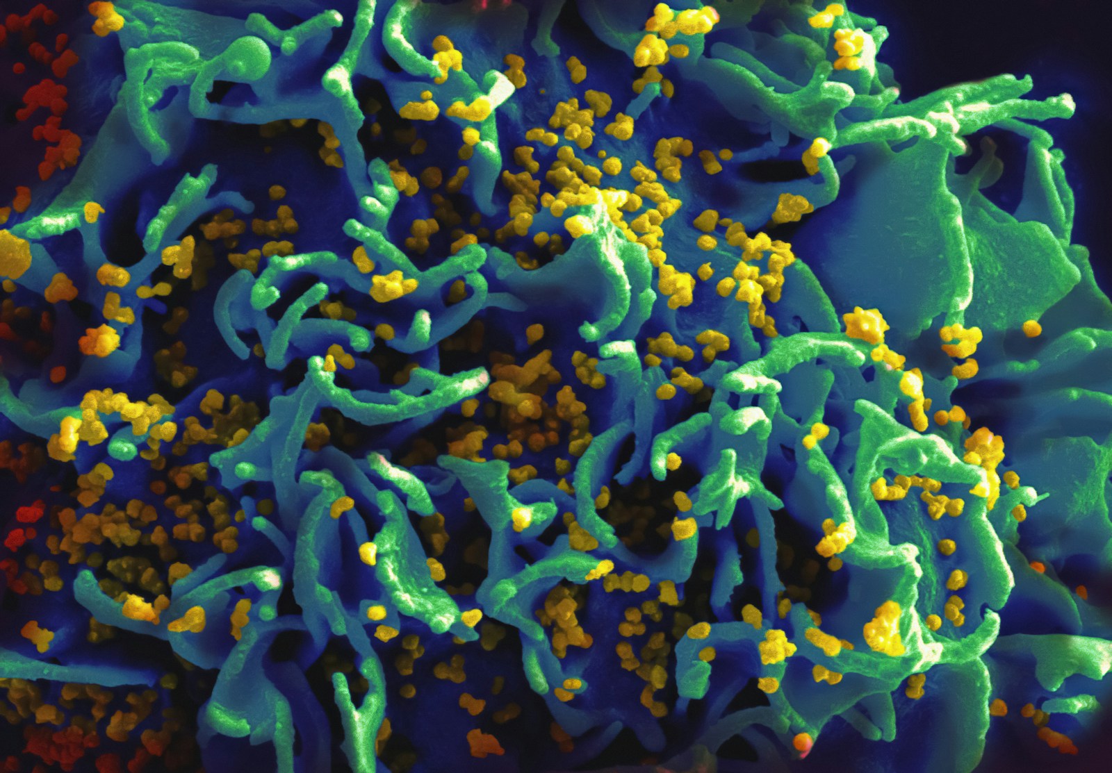 Bacterial Antimicrobial Resistance, Global Health Crisis, Antibiotic Resistance, AMR Trends, Drug Resistance, Antimicrobial Resistance Forecast, AMR Analysis, Public Health, Infectious Diseases, Antibiotic Misuse, Superbugs, Antimicrobial Agents, Drug-Resistant Bacteria, AMR Impact, Healthcare, Bacterial Infections, AMR Prevention, AMR Control, Antimicrobial Therapy, Resistance Mechanisms, AMR Surveillance, Resistance Patterns, Drug Development, AMR Management, Antibiotic Stewardship, AMR Research, Global Health Threat, AMR Projections, Antibiotic Overuse, AMR Strategies, Antimicrobial Resistance Epidemiology, AMR Consequences, AMR Challenges, AMR Solutions, AMR Data Analysis, AMR Forecasting, Antibiotic Effectiveness, AMR Trends Analysis, AMR Risk Factors, AMR Control Measures, AMR Impact Assessment, AMR Monitoring, AMR Crisis, Antibiotic Resistance Crisis, AMR Worldwide, AMR Reports, AMR Studies, AMR Implications, AMR Future Trends, Antibiotic Resistance Analysis, AMR Modeling, AMR Public Health Impact, superbug crisis,