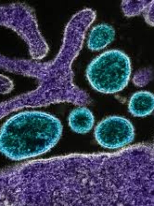 nipah virus